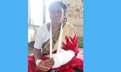 தென்காசி அரசு மருத்துவமனையில் இதய நோயால் பாதிக்கப்பட்ட பெண்ணுக்கு எலும்பு முறிவு சிகிச்சை