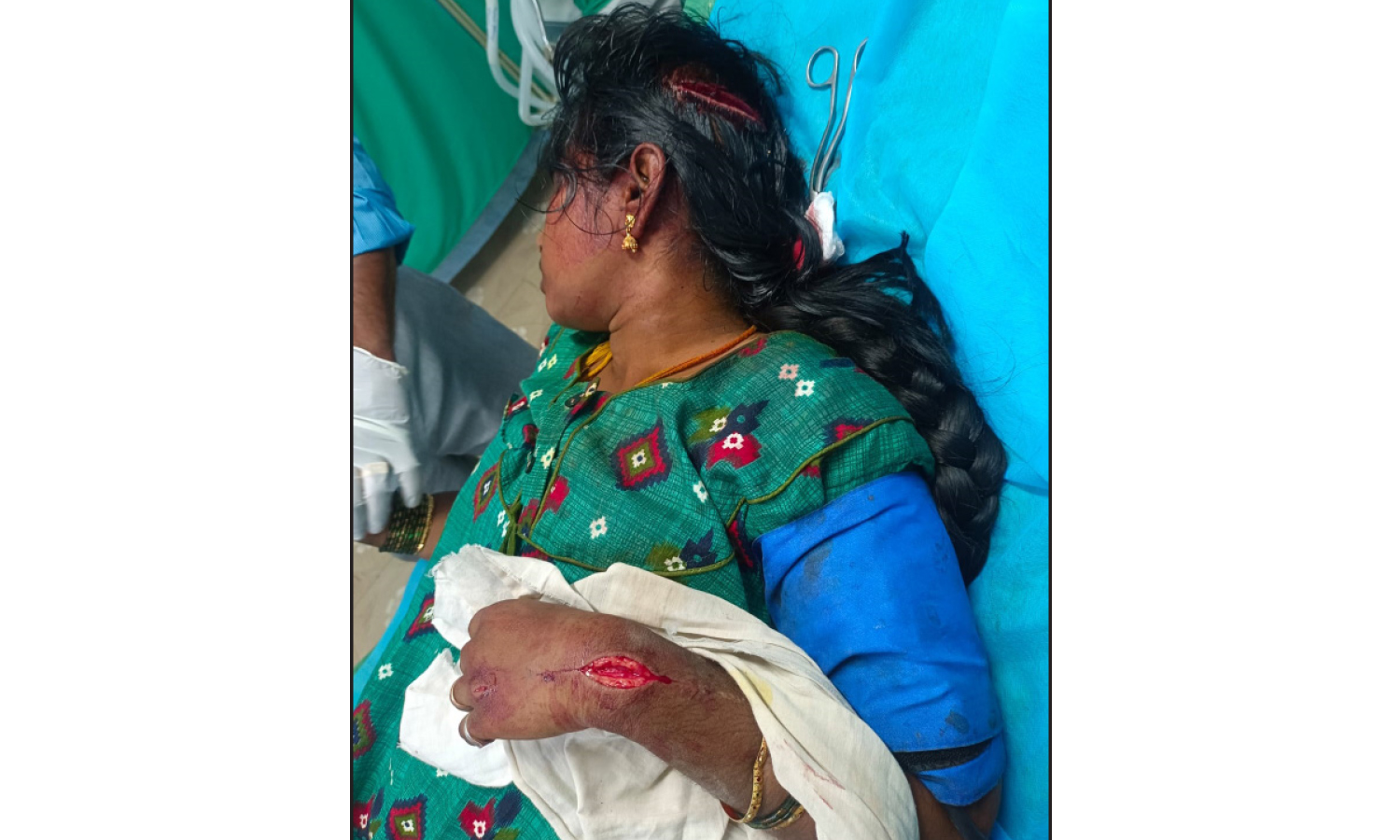 திருமணமாகி 15 நாளில் கசந்த காதல்: மனைவியின் நடத்தையில் சந்தேகப்பட்டு கொல்ல முயன்ற கணவன் கைது திருமணமாகி 15 நாளில் கசந்த காதல்: மனைவியின் நடத்தையில் சந்தேகப்பட்டு கொல்ல முயன்ற கணவன் கைது