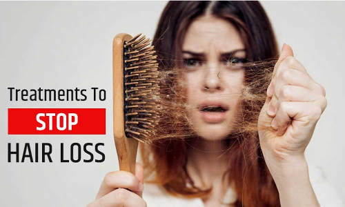 பெண்களுக்கு தொடர்கதையாகும் முடி உதிர்வு பிரச்சனை... காரணமும், தீர்வும்....