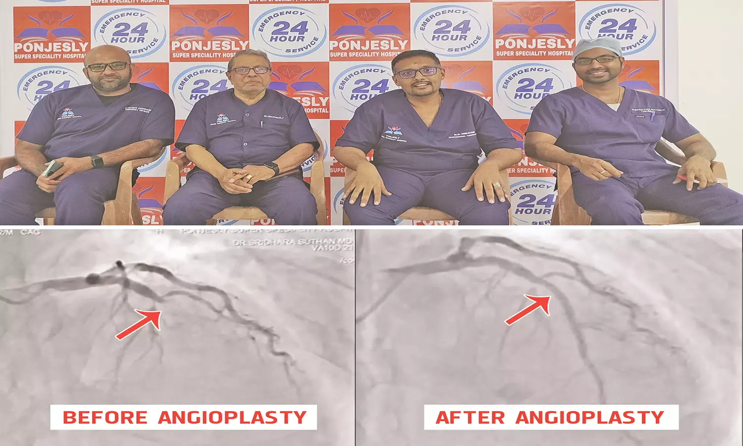 நோயாளிக்கு ரத்தக்குழாய் அடைப்பு நீக்கி  பொன்ஜெஸ்லி மருத்துவமனை டாக்டர்கள் சாதனை