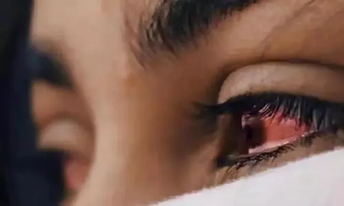 தென்காசி மாவட்டத்தில் வேகமாக  பரவி வரும் மெட்ராஸ்-ஐ