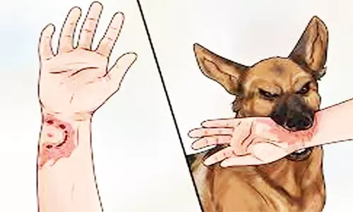 நாய் கடித்து பள்ளி மாணவி காயம்