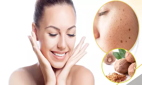 முகத்தில் சுருக்கம் வருவதை தடுக்கும் ஜாதிக்காய்