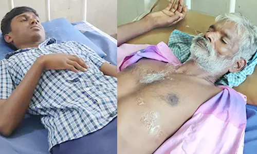 கதண்டு கடித்து 30 பேர் காயம்; ஆஸ்பத்திரியில் சிகிச்சை