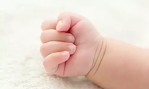 4 கால்களுடன் பிறந்த குழந்தை- அதிர்ச்சியில் டாக்டர்கள்