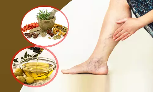 வெரிகோஸ் வெயின் பிரச்சனைக்கு சித்த மருத்துவத்தில் தீர்வு உண்டா?