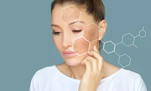 முகத்தில் வரும் கருந்திட்டுகள்... நிரந்தர தீர்வு தரும் சித்தமருந்துகள்