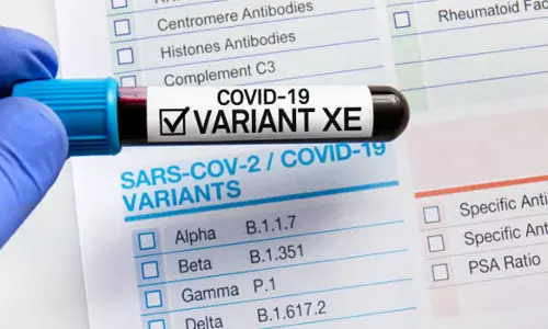 சீனாவில் இருந்து வந்தவருக்கு பாதிப்பு- விமானத்தில் கோவை வந்த 166 பயணிகள் கண்காணிப்பு