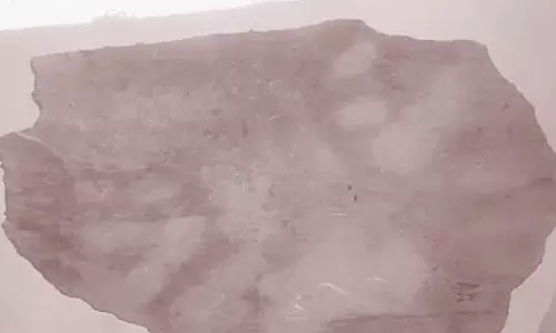 அங்கன்வாடி கட்டிட மேற்கூரை சிமெண்டு பெயர்ந்து விழுந்தது 