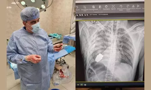 ராணுவ வீரரின் மார்பை துளைத்த கையெறி குண்டு: துணிச்சலாக அறுவை சிகிச்சை செய்து அகற்றிய டாக்டர்