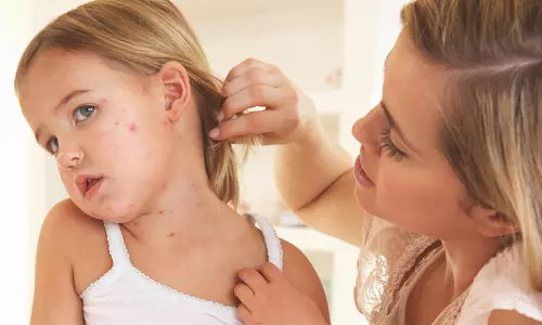 குழந்தைகளிடையே பொதுவாக காணப்படும் ஒவ்வாமை வகைகள்