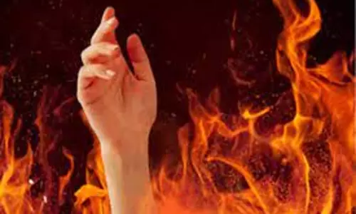 சாலையோரம் தூங்கிய தொழிலாளி மீது தீ வைப்பு