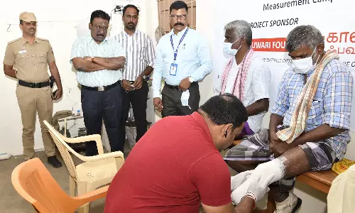 தேனி மாவட்டத்தில் செயற்கை கால் வழங்குவதற்கான அளவீட்டு முகாம் கலெக்டர் முரளிதரன் தொடங்கி வைத்தார்