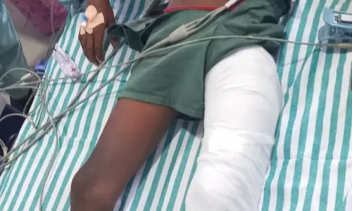 பள்ளி இரும்பு கேட்டு விழுந்து மாணவனின் கால் எலும்பு முறிவு