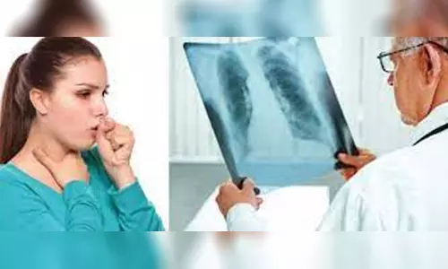 81 ஆயிரம் பேருக்கு காசநோய் பரிசோதனை