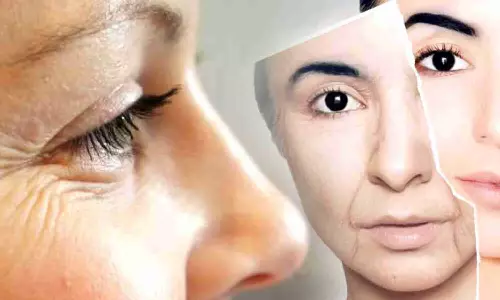 இளம் வயதில் முகத்தில் சுருக்கமா? அப்ப இந்த  பேஸ் பேக் போடுங்க...