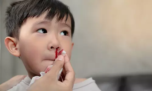 குழந்தைகளுக்கு மூக்கிலிருந்து இரத்தம் வரக்காரணம்...