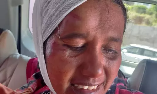 கோத்தகிரியில் காட்டெருமை தாக்கி பெண் படுகாயம்