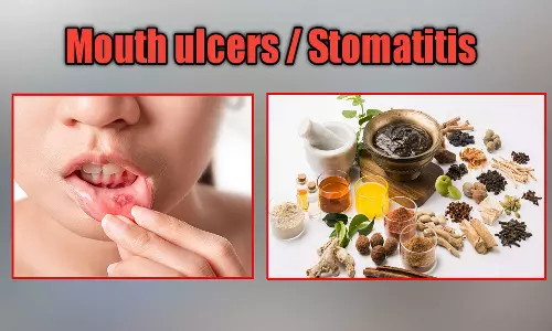 வாய்ப் புண் குணமாக சித்த மருந்துகள்