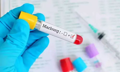 ஆப்பிரிக்காவில் பரவும் புதிய கொடிய வகை தொற்றுக்கு 9 பேர் உயிரிழப்பு