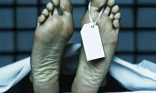 தீயில் உடல் கருகி பெண் சாவு