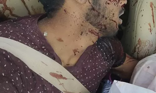 கார்-டிப்பர் லாரி நேருக்கு நேர் மோதி வாலிபர் பலி