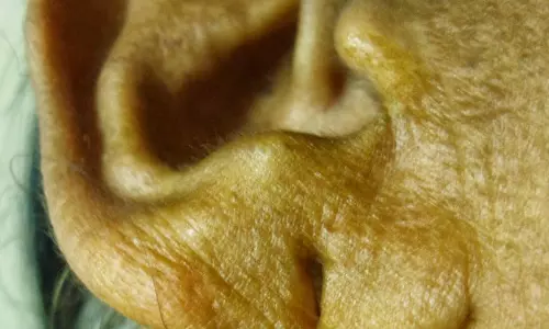 காதில் மருந்து ஊற்றிய மூதாட்டி சாவு