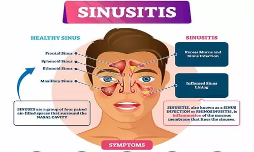 சைனஸ் பிரச்சினையிலிருந்து விடுபட எத்தகைய சிகிச்சை தேவை?