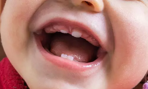 குழந்தைகளுக்கு பற்கள் முளைக்கும்போதே ஏன் சொத்தையாக வளர்கிறது தெரியுமா?