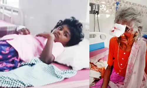 செம்பட்டி அருகே வெறிநாய் கடித்து 15 பேர் படுகாயம்;  2 ஆடுகள் பலி