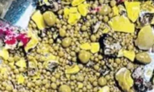 ஆந்திராவில் முதியவர் கிட்னியில் 3 ஆயிரம் கற்கள்- டாக்டர்கள் அதிர்ச்சி