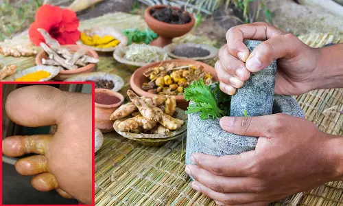 கால் விரல் இடுக்குகளில் வரும் சேற்றுப்புண்... தீர்வு தரும் சித்த மருத்துவம்...