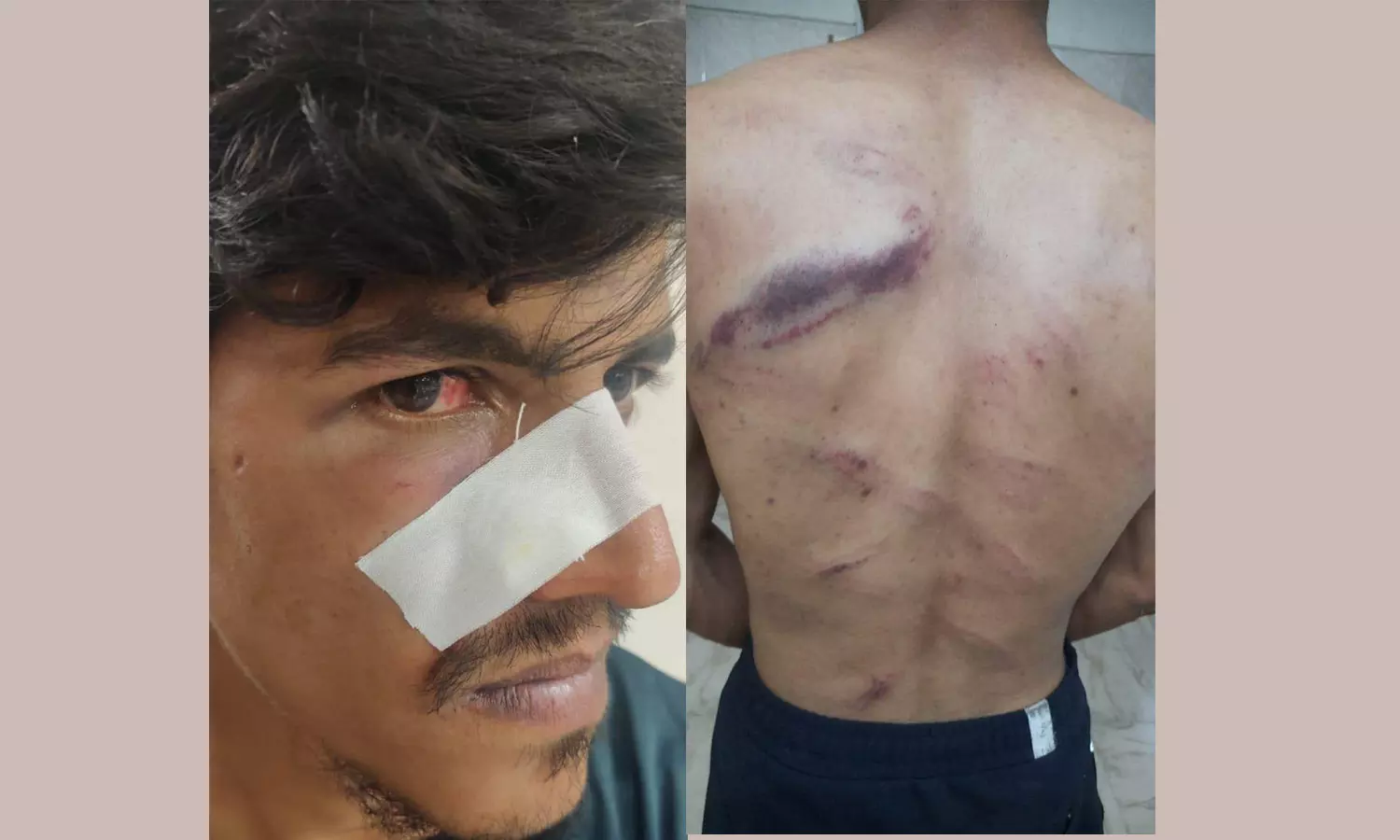 காதல் தகராறில் துணை நடிகரை கடத்தி தாக்குதல்- காதலியின் உறவினர்கள் மீது புகார் காதல் தகராறில் துணை நடிகரை கடத்தி தாக்குதல்- காதலியின் உறவினர்கள் மீது புகார்