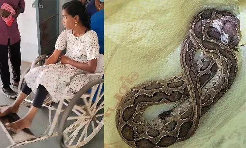 கல்லூரிக்குள் புகுந்து மாணவியை கடித்த விஷ பாம்பு- ஆபத்தான நிலையில் ஆஸ்பத்திரியில் சிகிச்சை