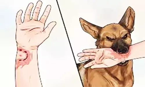 தெரு நாய் கடித்து சிறுவர்கள் உள்பட 7 பேர் காயம்