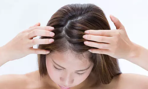 முடி வளர்ச்சிக்கு முக்கியமான ஸ்கால்ப்பை பராமரிப்பது எப்படி?