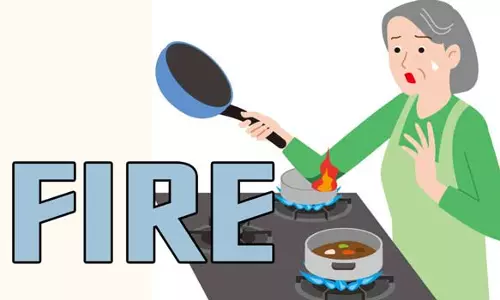 தீயில் காயம் அடைந்த  இளம் பெண் சாவு