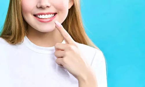 முக அழகுக்கு உதவும் இம்பிளான்ட் நிரந்தர பற்கள்