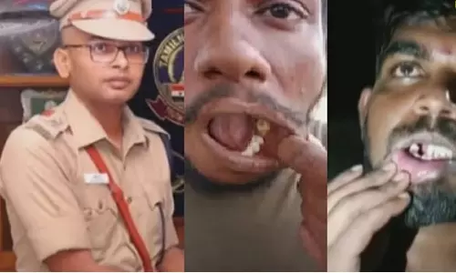 நெல்லையில் விசாரணை கைதிகளின் பற்களை பிடுங்கிய விவகாரம்- ஏப்.10 வரை புகார் அளிக்க அனுமதி