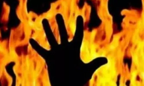 ஏலச்சீட்டு அலுவலகத்தில் தொழிலாளி தீக்குளிப்பு- எரியும் தீயுடன் பெண் ஊழியரை பிடித்ததால் அவரும் கருகினார்