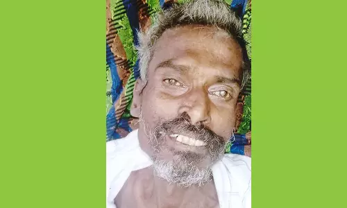 மதுரை அரசு ஆஸ்பத்திரியில் மயங்கி விழுந்து இறந்தவர் யார்?