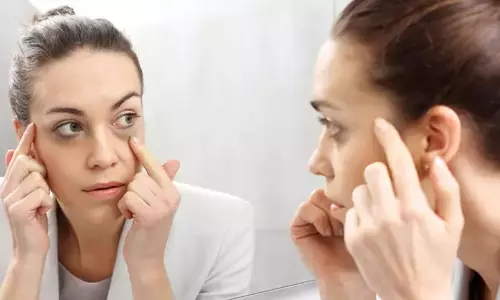 கண்ணை சுற்றி கருவளையமா... இதை மட்டும் செய்யுங்க உடனே நீங்கிவிடும்...