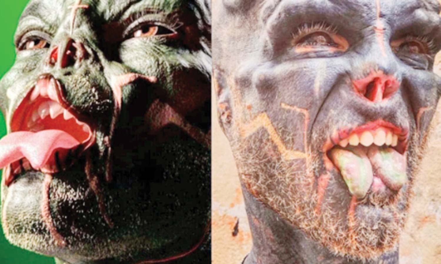 அறுவை சிகிச்சை செய்து உடலை ஏலியன் போல மாற்றிய வாலிபர்