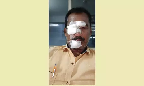 பீர் பாட்டில் வெடித்து கண்பார்வை இழந்த டாஸ்மாக் விற்பனையாளர்- ஆஸ்பத்திரியில் தீவிர சிகிச்சை