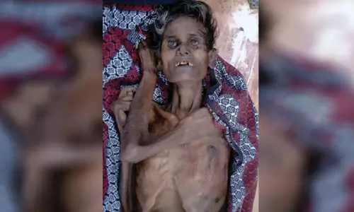 சேலத்தில் மயங்கி விழுந்த மூதாட்டி சாவு