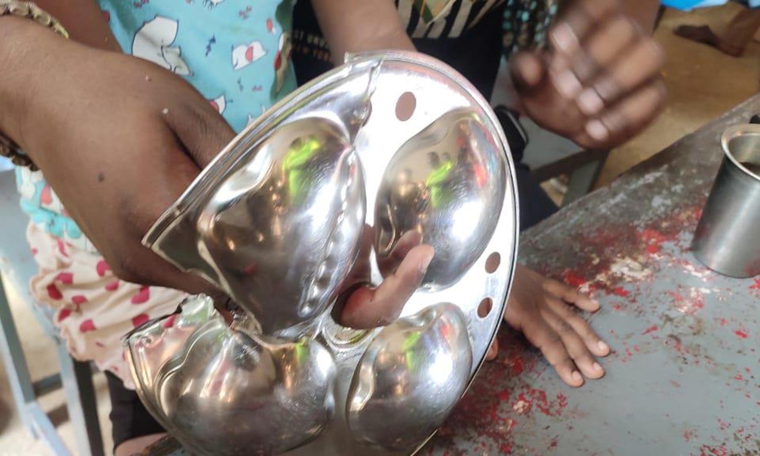 இட்லி தட்டில் சிக்கிய குழந்தையின் விரல்- தீயணைப்பு வீரர்கள் போராடி மீட்டனர்