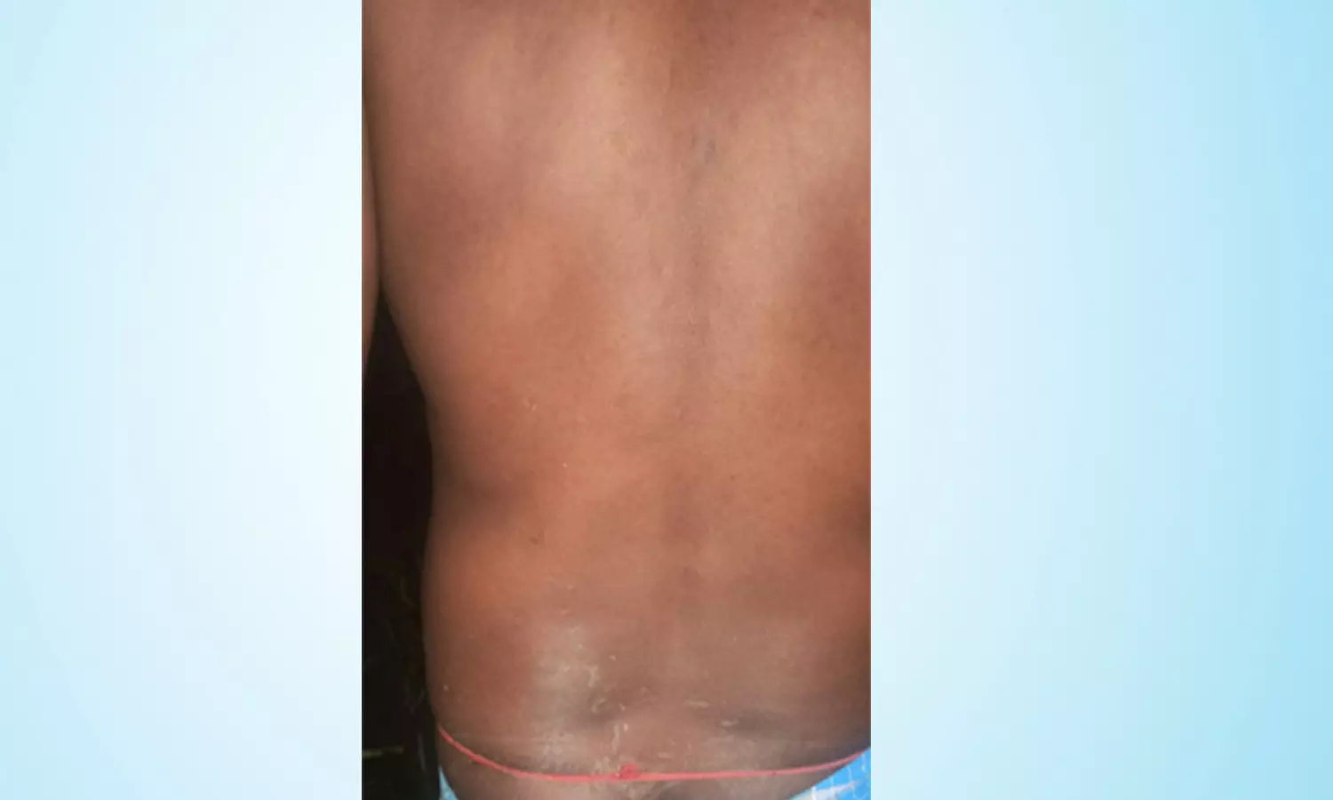 காட்டு யானைகள் விரட்டியதில் விவசாயி காயம் காட்டு யானைகள் விரட்டியதில் விவசாயி காயம்