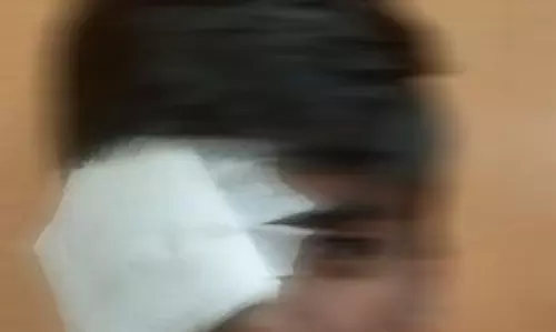 சிறுவன் மீது தாக்குதல்