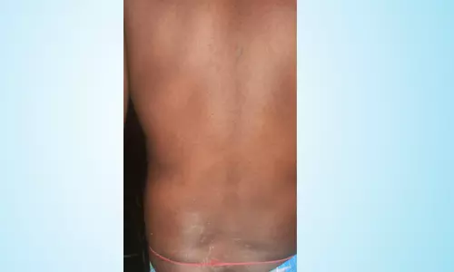 காட்டு யானைகள் விரட்டியதில் விவசாயி காயம்