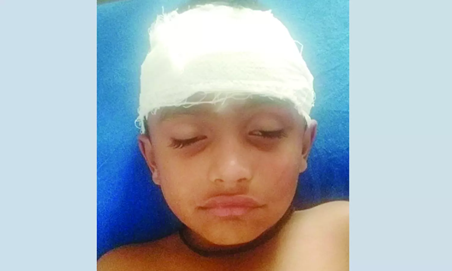 போடி அருகே பைக்கில் சிக்கிய சிறுவனை 20 அடி தூரம் இழுத்துச் சென்ற போதை வாலிபர்